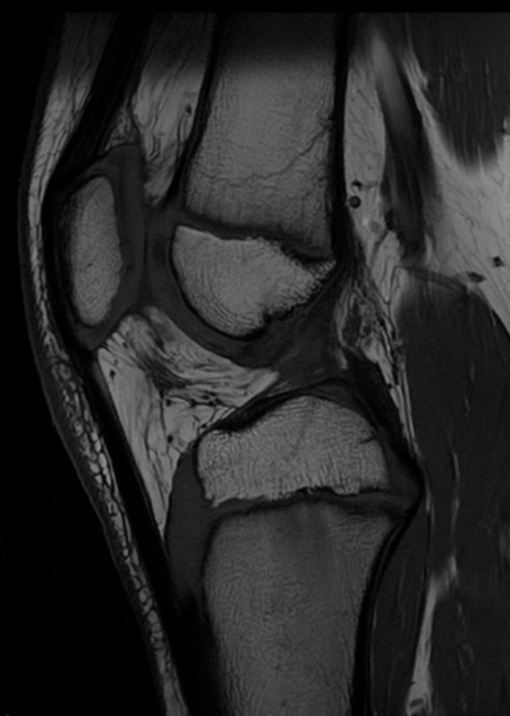 especialistas en lesiones de rodilla